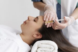 mesoterapia capilar en Valencia - densidad
