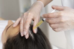 mesoterapia capilar en Valencia - raíz