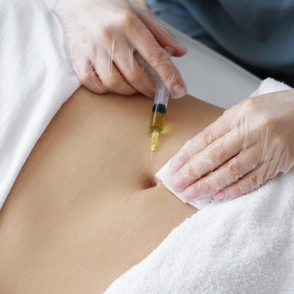 tratamiento con mesoterapia en valencia - abdomen
