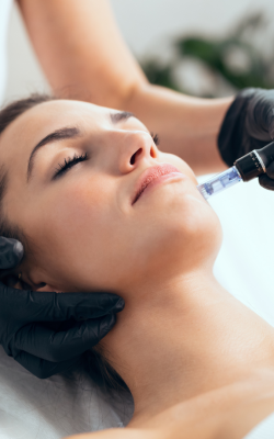 tratamientos de belleza en valencia – microneddling tratamientos de belleza en valencia - microneddling